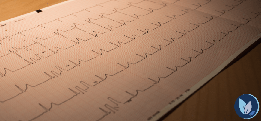 Ekg
